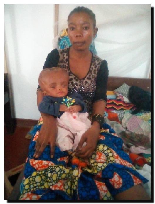 sick children in Congo DRC