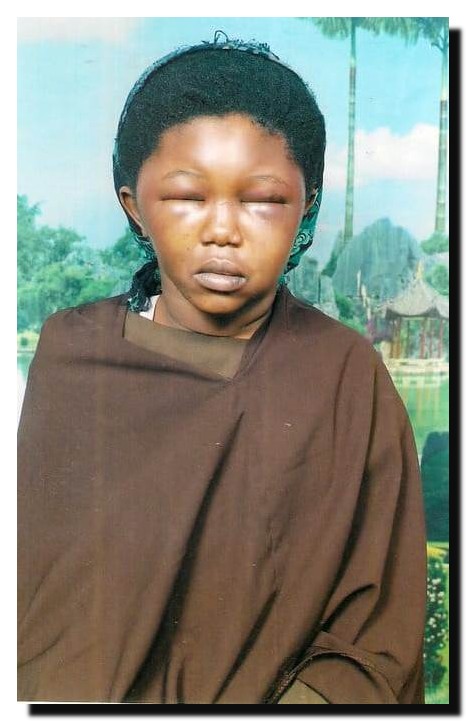 Child Abuse Somalia